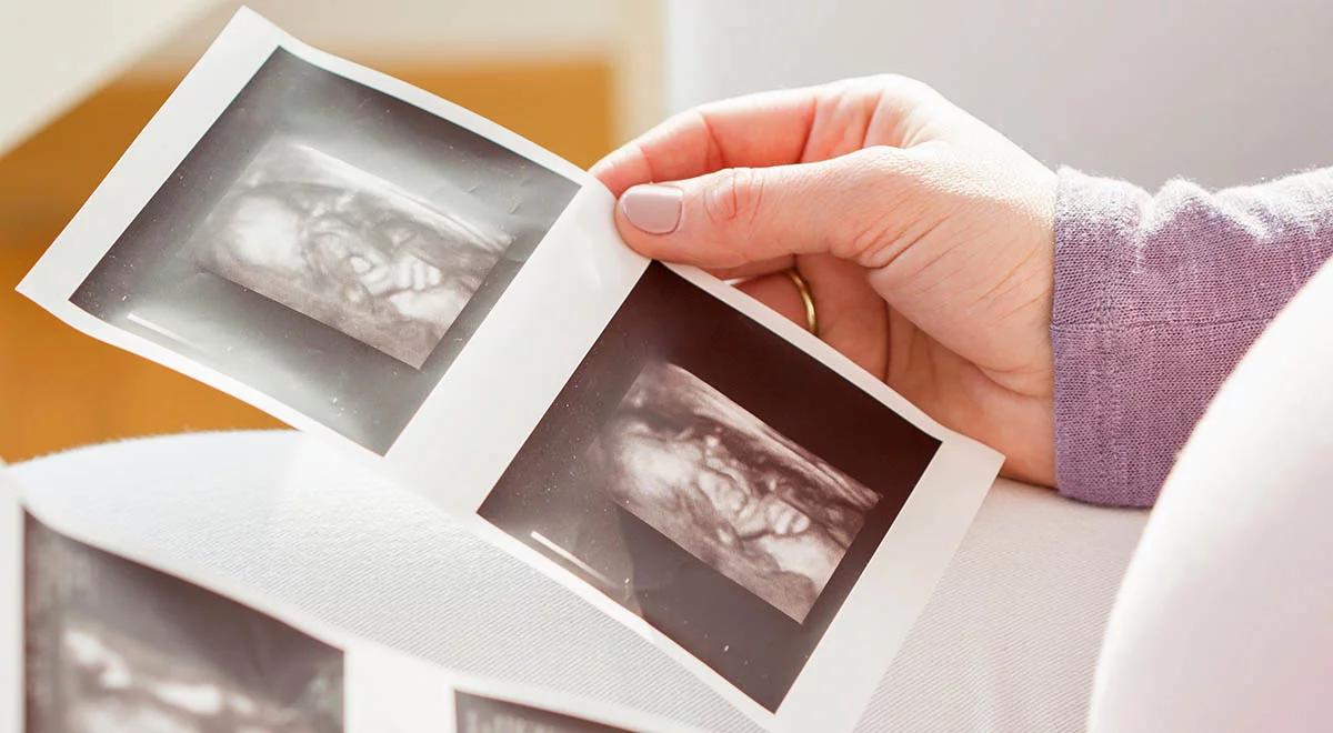 "Przekraczanie kompetencji UE". Europarlamentarzystki PiS krytykują rezolucję ws. aborcji w Polsce