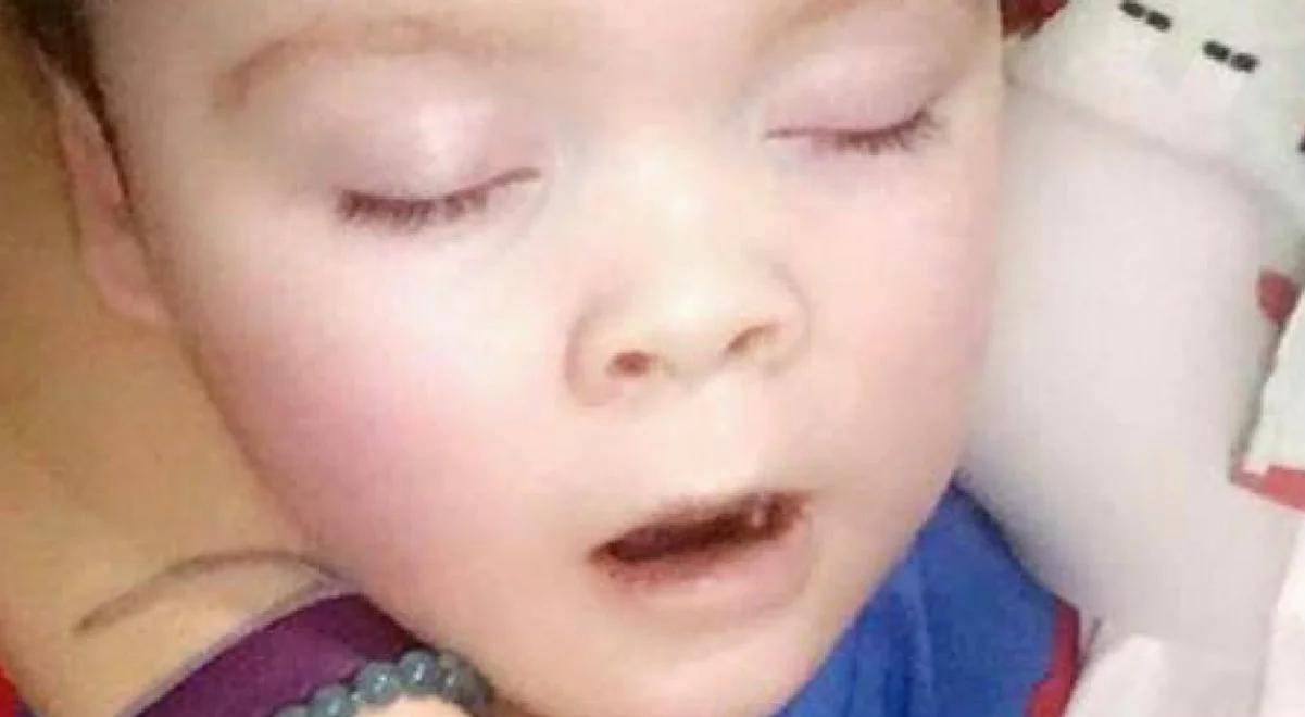 Alfie Evans. Co wiemy o chłopcu?