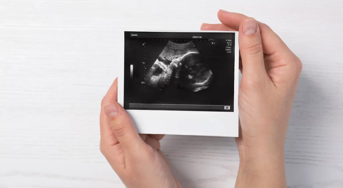 Wielka Brytania zalegalizowała domową aborcję. Ponad 600 lekarzy wystosowało sprzeciw