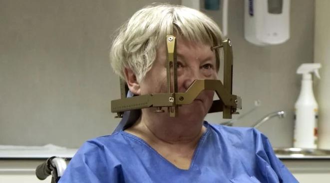 Chirurdzy na Śląsku będą używać Gamma Knife 