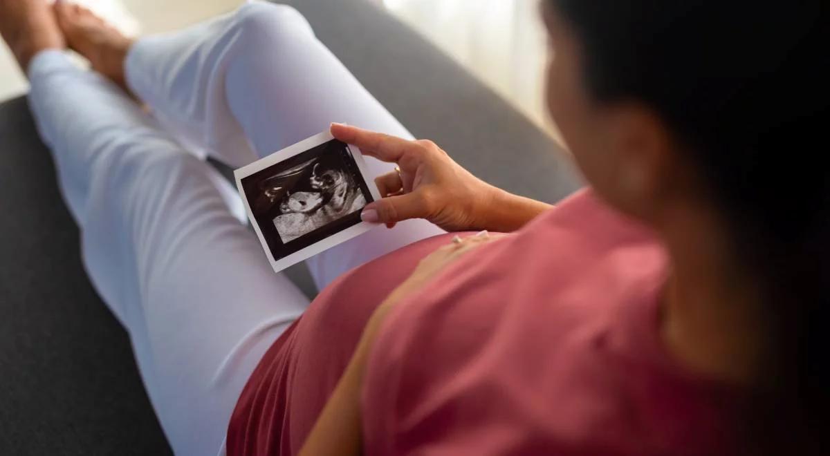 Perinatologia. Prof. Dębska: asystuję przy cudach 