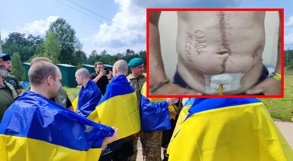 Rosjanie wypalili napis "Chwała Rosji" na ciele ukraińskiego jeńca