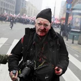 "Widać, jak podnosi strzelbę". Tomasz Gutry ma zdjęcie policjanta, który mógł do niego strzelić