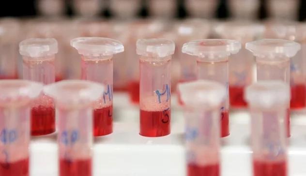 "Uzdrowiciel" zarażał uczniów zakażoną HIV krwią