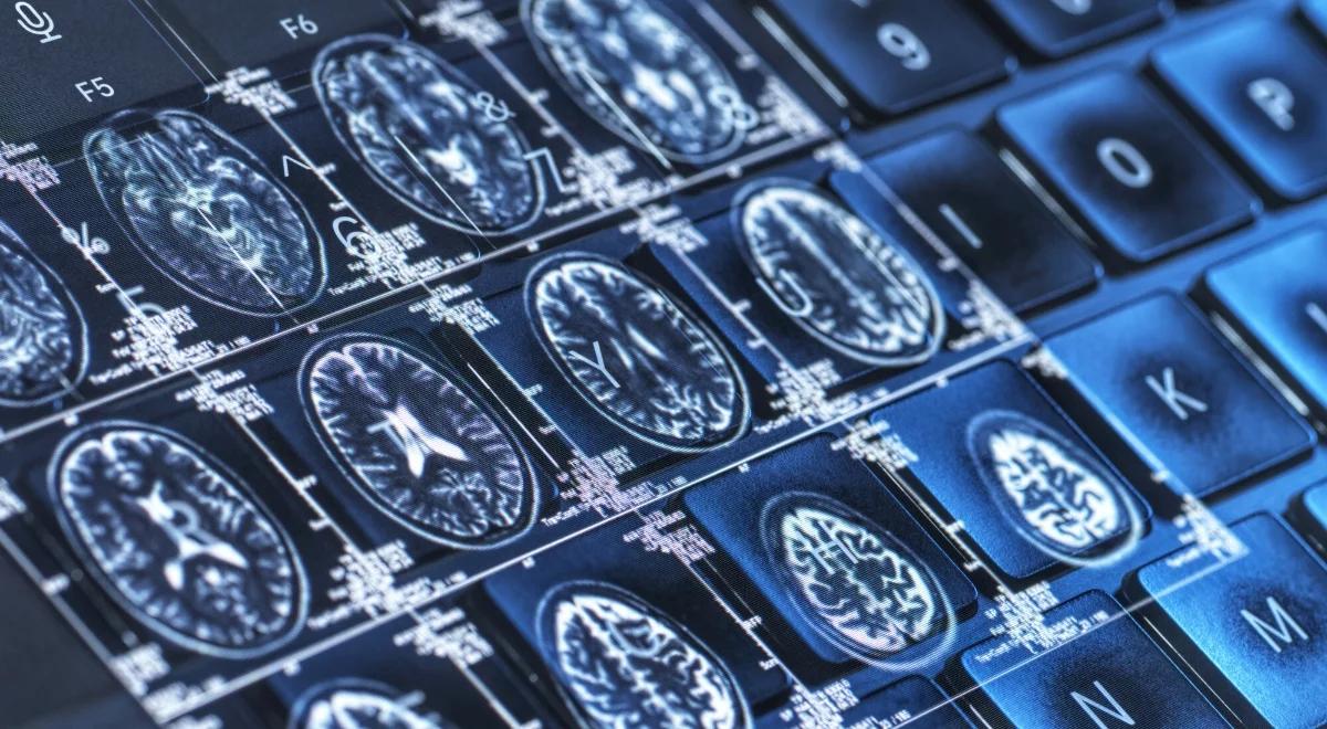 Zanieczyszczone powietrze wpływa na rozwój Alzheimera. "Wystarczy zaledwie rok"