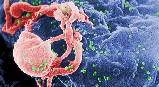 30 lat temu odkryto chorobę AIDS. Wirus HIV codziennie zaraża tysiące osób