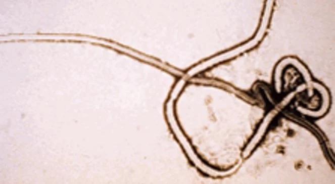 Epidemia wirusa Ebola w Gwinei. Tłum zaatakował lekarzy