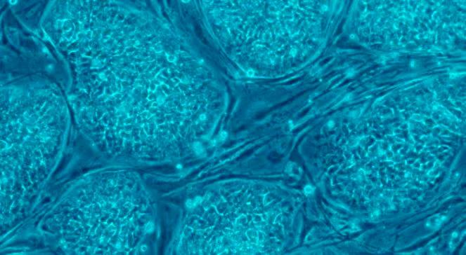 Superdokładny test komórek. Wykryje raka i HIV?