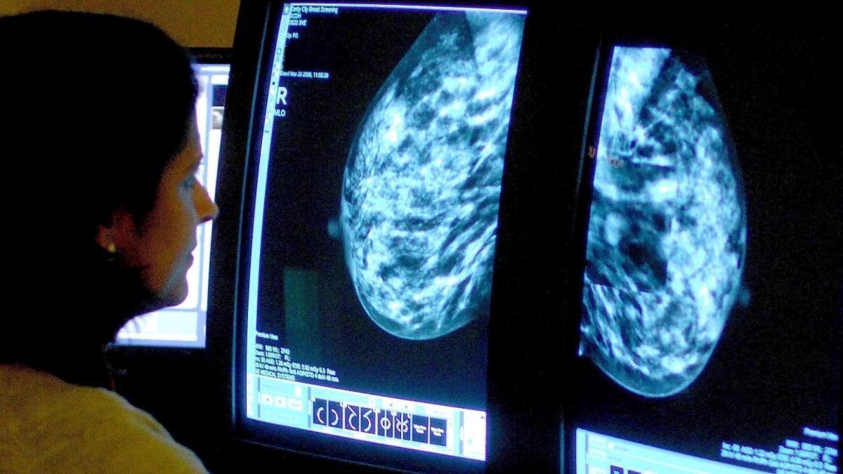 Różowy październik miesiącem badania piersi. "Polki boją się mammografii"