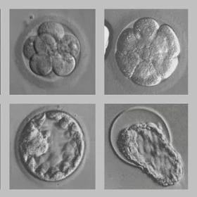 Nobel za in vitro jest "nie na miejscu"