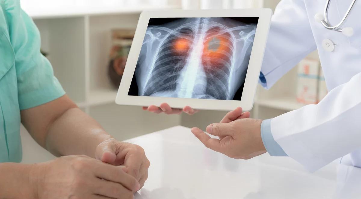 WOŚP zbiera na "płuca po pademii". Dr Karauda: na rehabilitację oddechową czeka się w Polsce 300 dni