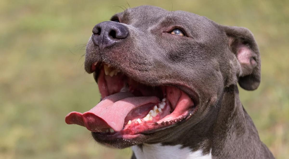 Amstaff rzucił się na dziecko. Dramat podczas zabawy