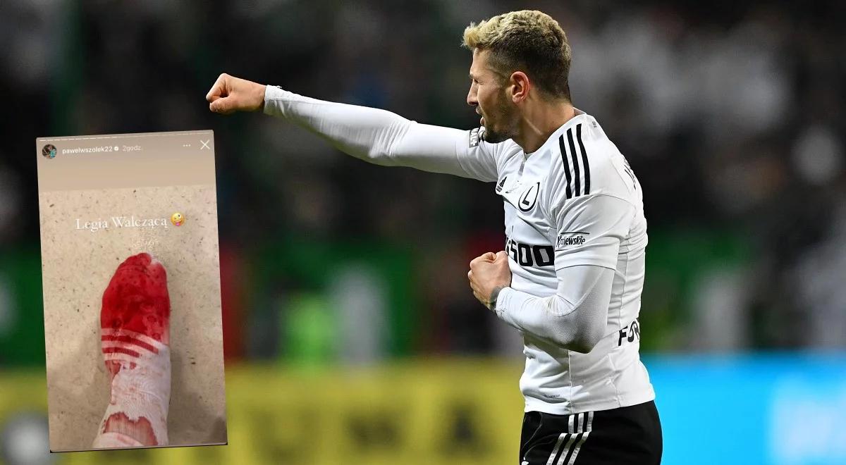 Ekstraklasa: krwawe zwycięstwo Legii. Paweł Wszołek zamieścił szokujące zdjęcie