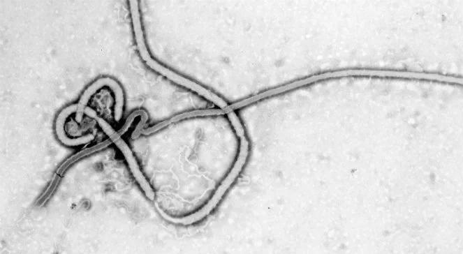 Nie ma eboli w Trójmieście. To była malaria