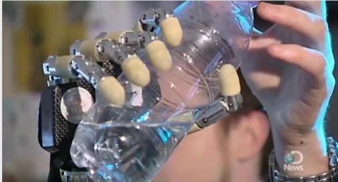 Amputuje sobie rękę, żeby mieć bioniczną protezę
