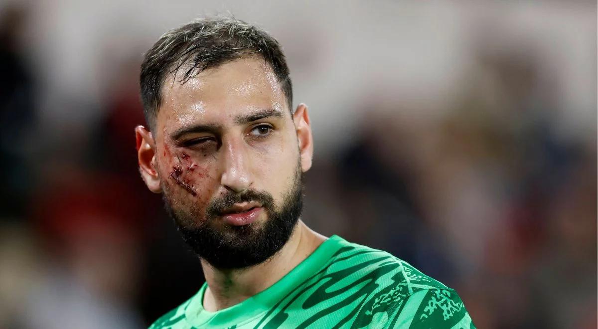 Donnarumma ma 9 szwów na twarzy. Przeprosiny po brutalnym faulu 