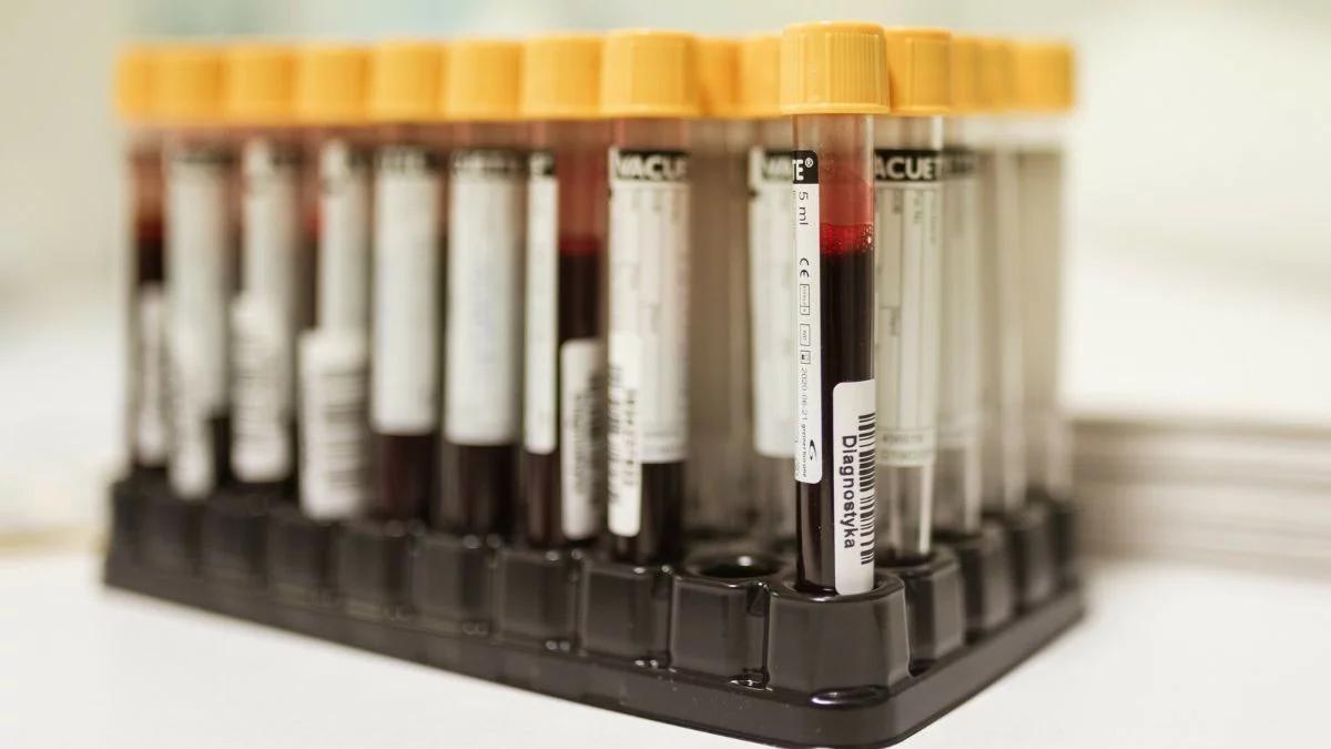 To będzie przełom w walce z nowotworami? Opracowano nowy test krwi