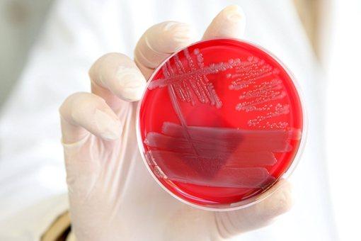 Światowa Organizacja Zdrowia: epidemię wywołał unikalny szczep bakterii