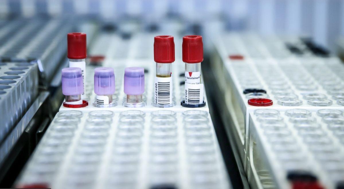 Szybkie testy na koronawirusa już w Polsce. Dają wynik w ciągu 15 minut