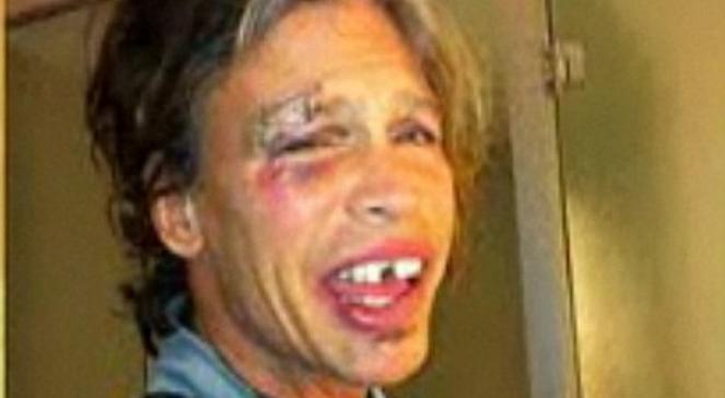 Lider Aerosmith z wybitymi zębami i szwami. "Zemdliło mnie"
