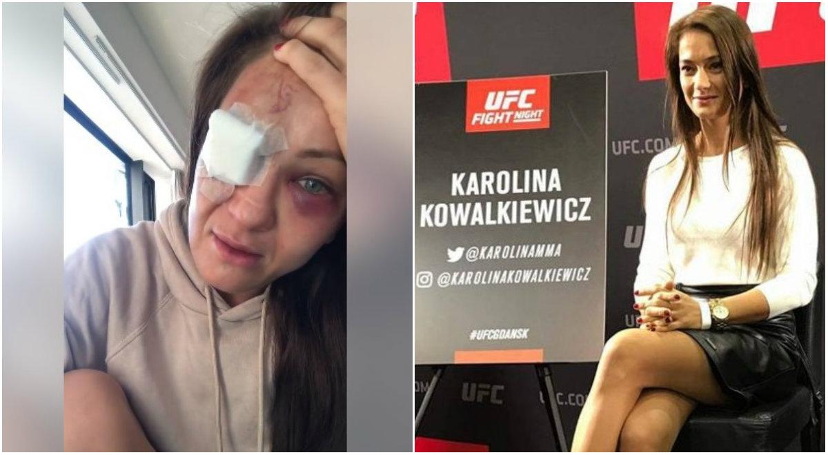UFC: Karolina Kowalkiewicz czeka na operację oka. "Podwójnie widziałam"  