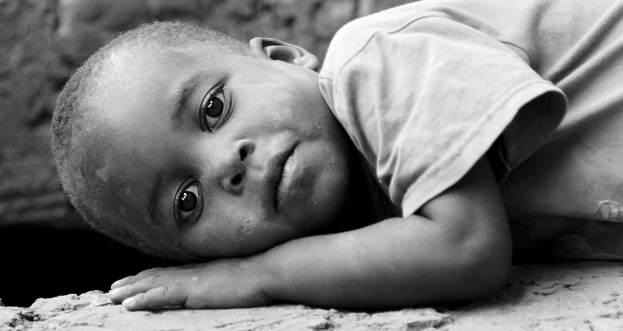Afryka umiera z głodu. UNICEF: liczba skrajnie niedożywionych dzieci w Somalii wzrosła o 50 proc.