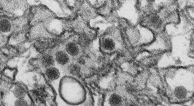 "Nie ma już żadnej wątpliwości". Przełomowe odkrycie dotyczące wirusa zika